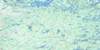 053A Wunnummin Lake Free Online Topo Map Thumbnail