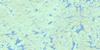 023M09 Lac Dorillard Topo Map Thumbnail