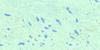 032L03 Lac Spradbrow Topo Map Thumbnail