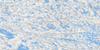 034J02 Lac Montrenault Topo Map Thumbnail